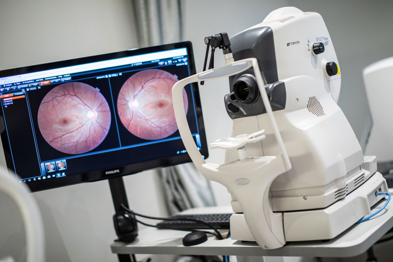 Dr Jimmy Lim JL Eye Specialists Clinic in Singapore RI OCT Triton Diagnostic Machine Fundus Imaging