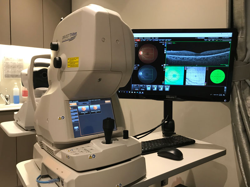Dr Jimmy Lim JL Eye Specialists Clinic in Singapore RI OCT Triton Diagnostic Machine Zoom