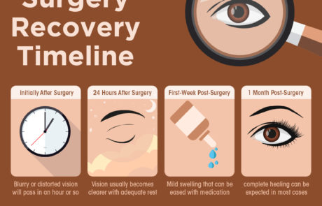 Cataract Surgery Recovery Timeline