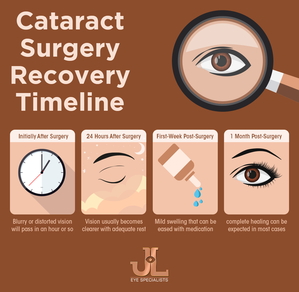 Cataract Surgery Recovery Timeline