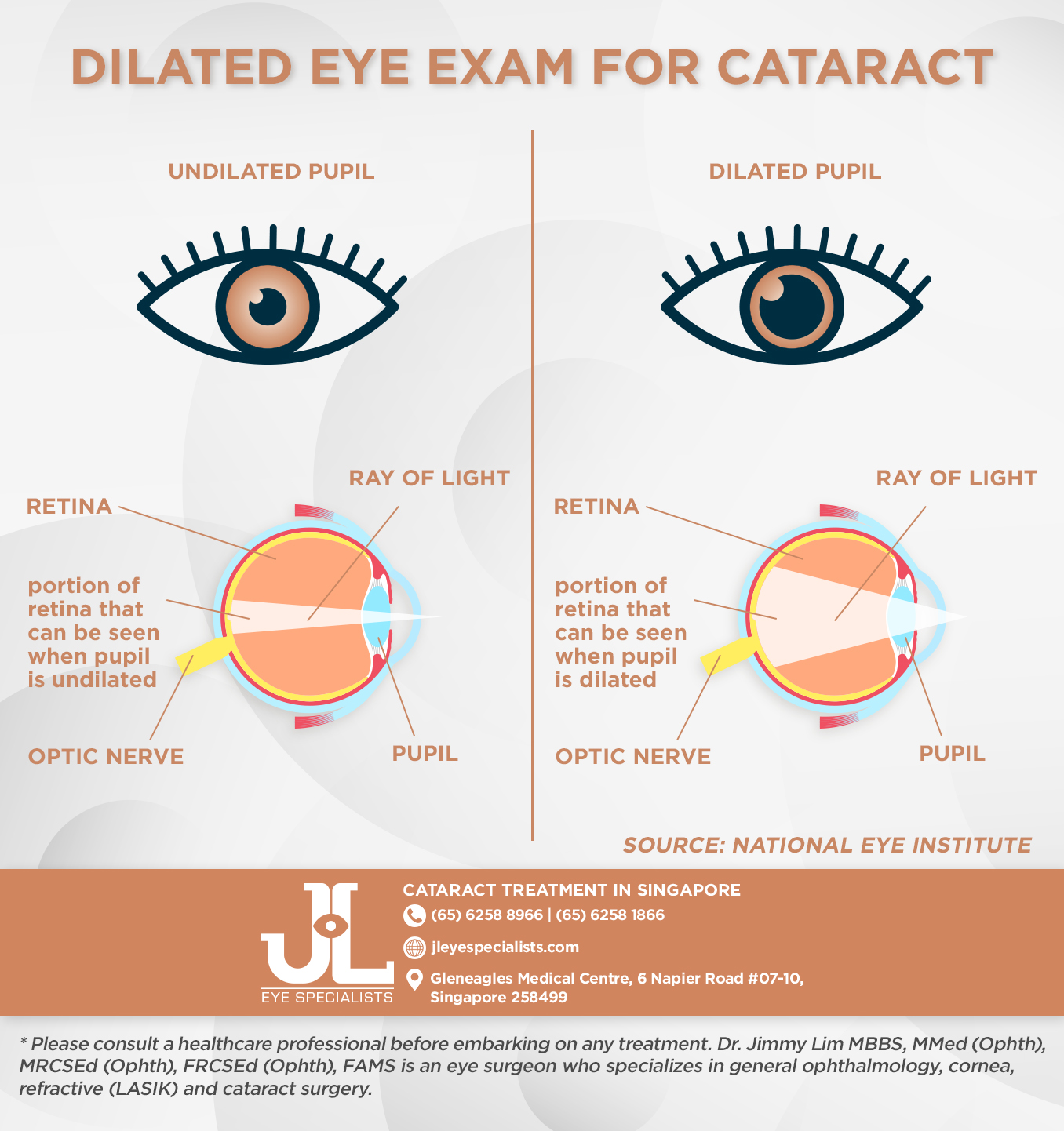 dilated eye exam