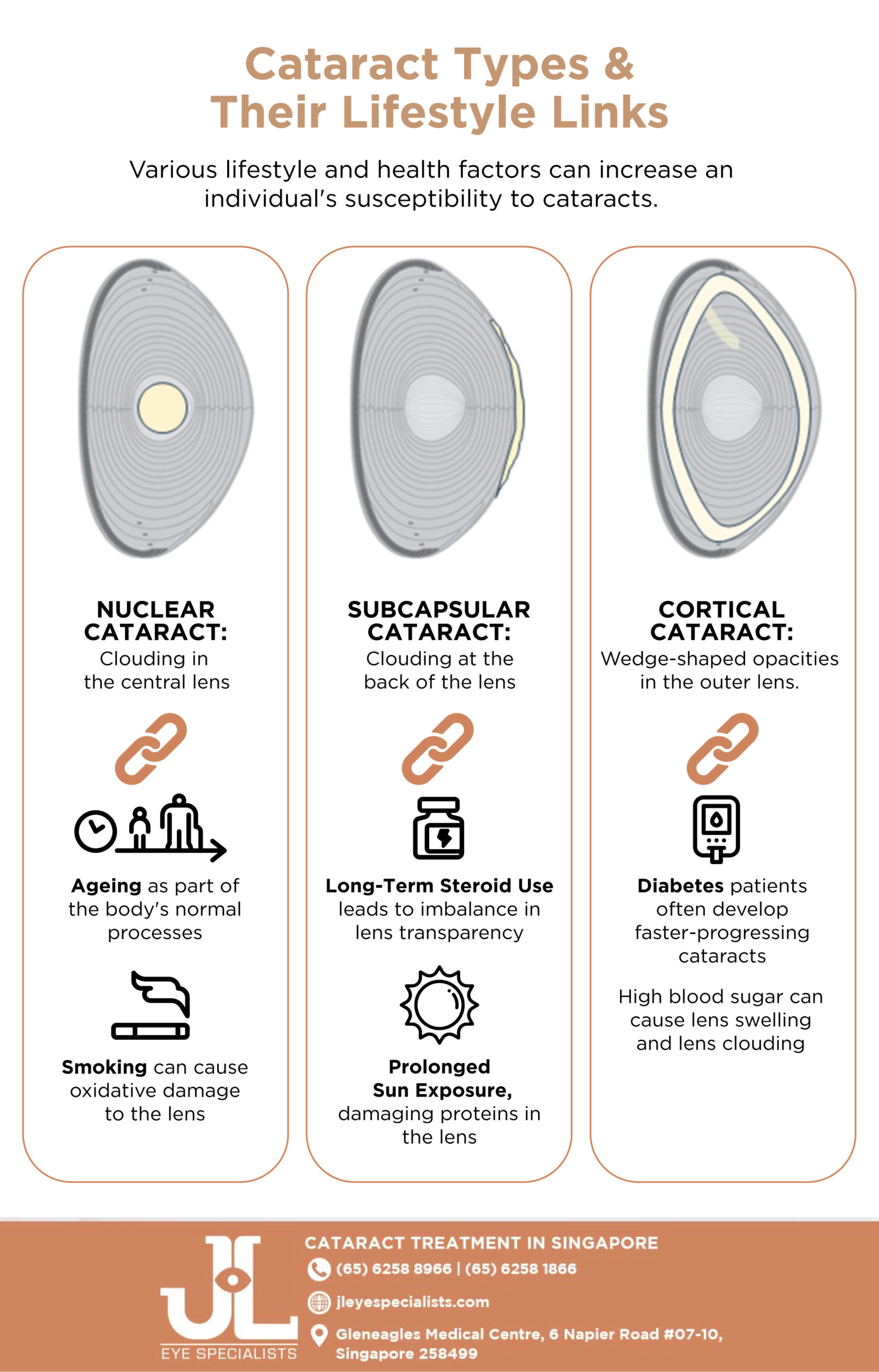 JLE_Cataract Links_Oct_infographic_1 cataract types and lifestyle links